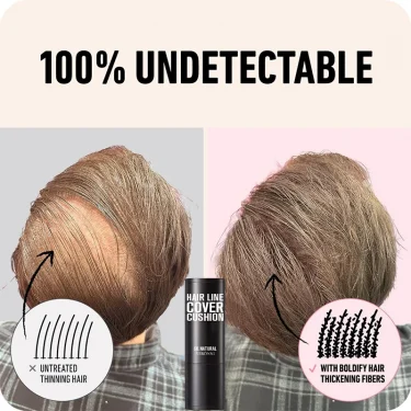 A Multi-Functional Face and Brow Powder To Fill in The Hairline,Portable Hairline Repair Powder for Grey Hair Roots and Thinning 4