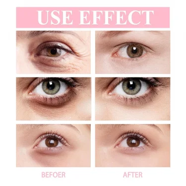 Retinol Anti-wrinkle Eye Cream Anti Puffiness Remove Dark Circles Eye Bags Stick Fade Fine Line Whitening Moisturizing Skin Care 3