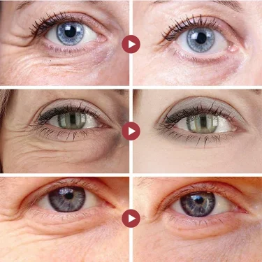 Retinol Eye Cream Lifting Firming Anti-Wrinkle Remove Eye Bags Dark Circles Anti Aging Whitening Moisturizing Brighten Skin Care 4