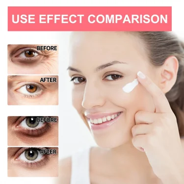 Retinol Eye Cream Lifting Firming Anti-Wrinkle Remove Eye Bags Dark Circles Anti Aging Whitening Moisturizing Brighten Skin Care 6