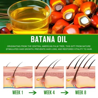 Raw Batana Oil for Hair Growth 100% Natural Can Prevent Hair Loss in Both Men and Women Increase Hair Thickness and Smoothness 3